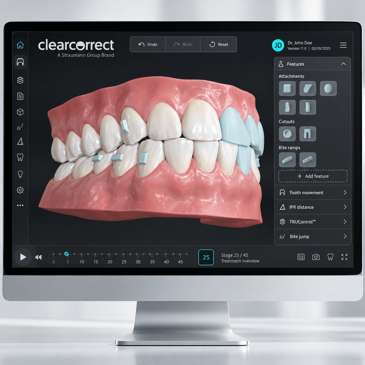 3d моделирование зубов при ортодонтическом лечении
